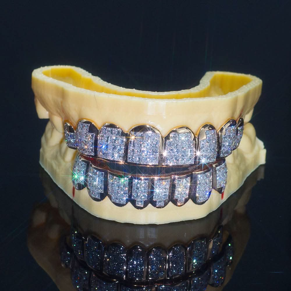 8 on 8 VVS Baguette Moissanite Diamond Grillz