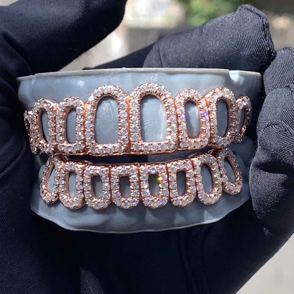 Rose Gold Open Face Custom Diamond Grillz