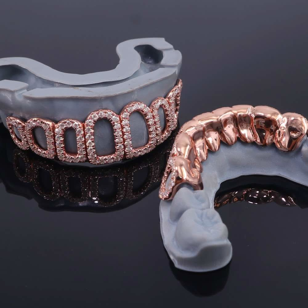 Rose Gold Open Face Custom Diamond Grillz